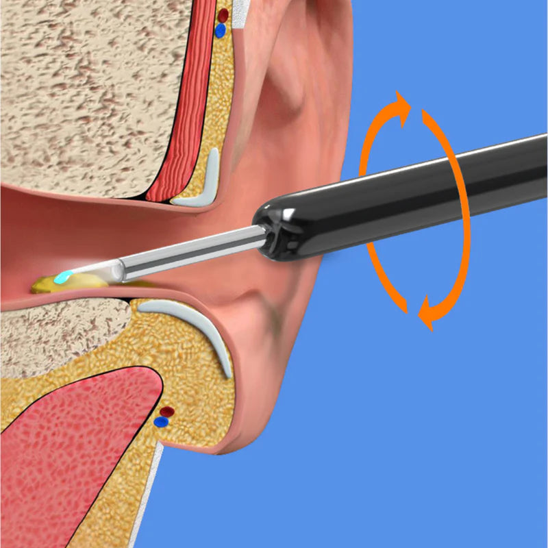 iScope Pro Max®️ Limpiador de Oidos Electrico